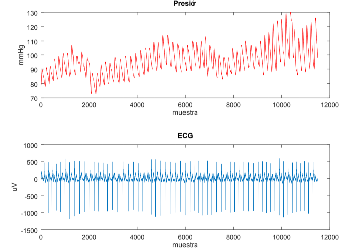 Registro ECG y Presión